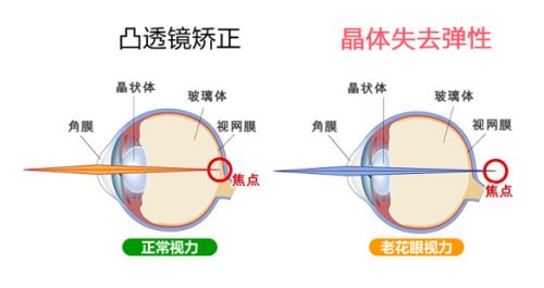 老花眼示意图