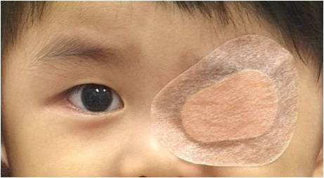 小儿斜视,小儿弱视,儿童眼科疾病,惠州希玛眼科